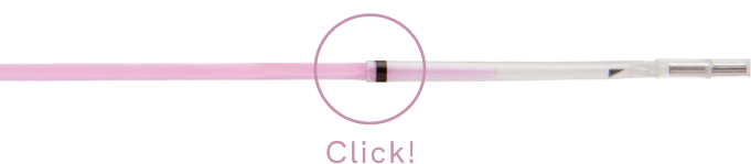 CRYOTEC PRO Secured Capping